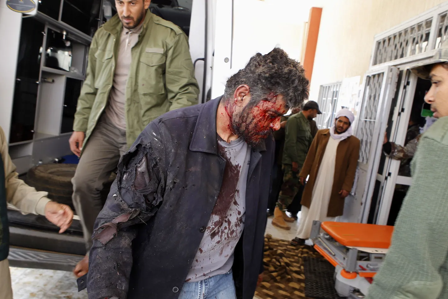 Один из пострадавших в результате ошибочного авиаудара западных союзников Ливии по повстанцам. Погибли около 10 повстанцев.