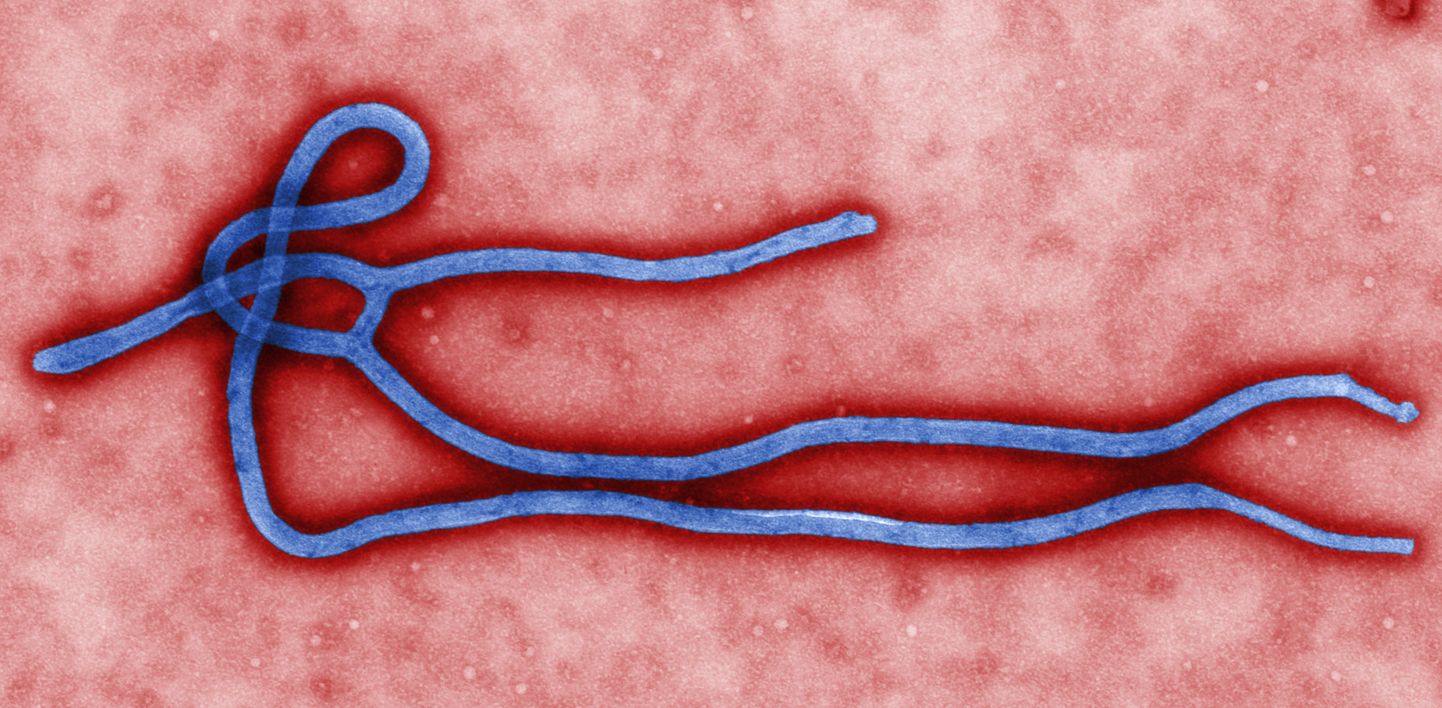Ebolas vīruss
