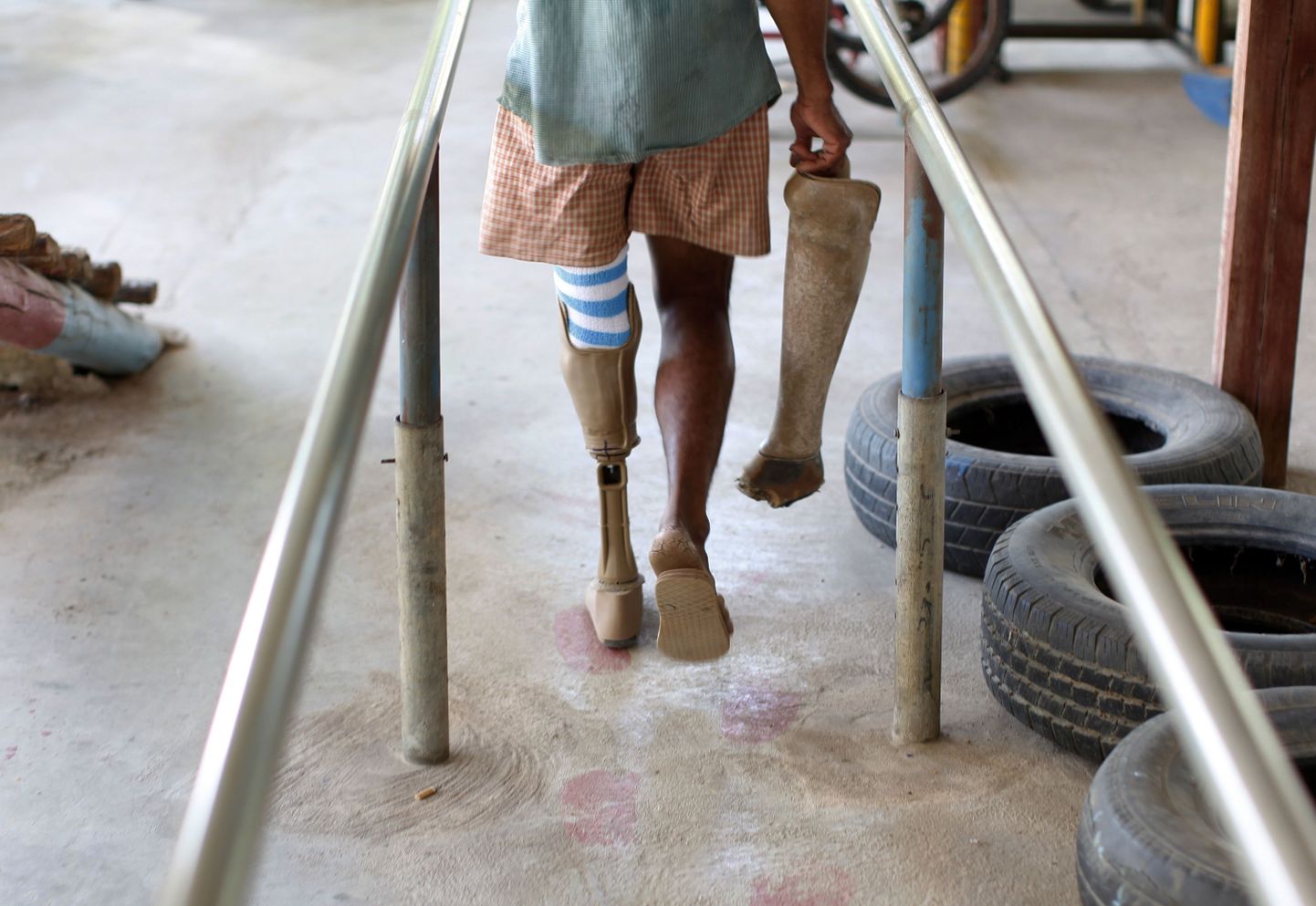 Maamiini tõttu jala kaotanud kambodžalane uue proteesiga Handicap Internationali taastusravikeskuses.