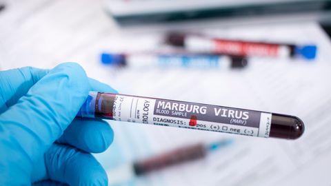 Ghanas on puhkenud eluohtlik Marburgi viirus, millele pole ravi
