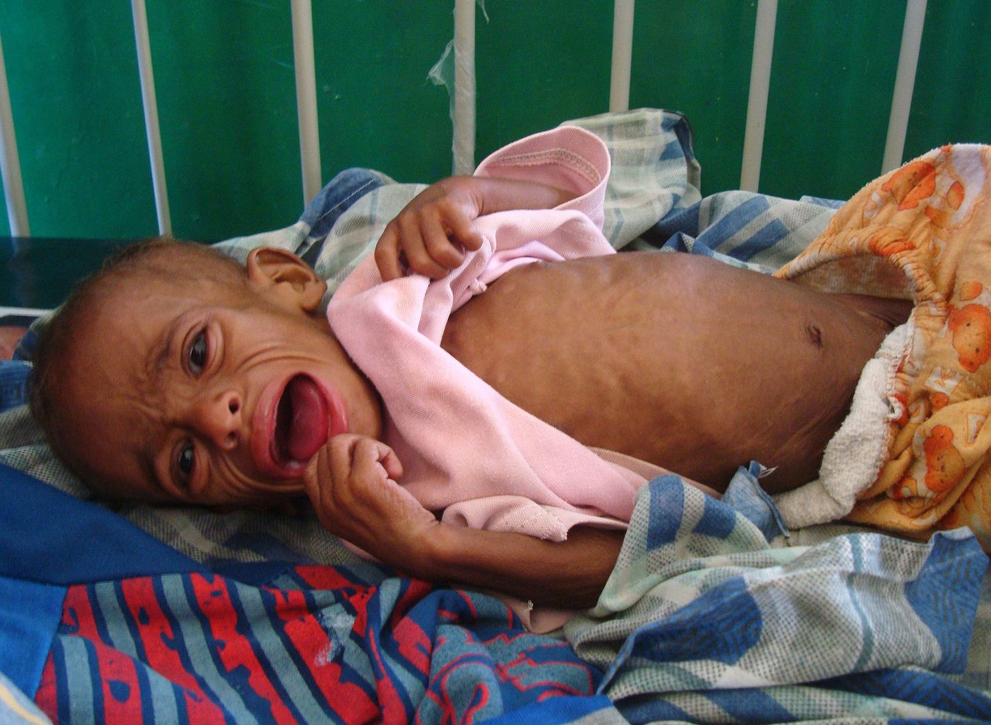 Haiglasse viidud somaali laps.