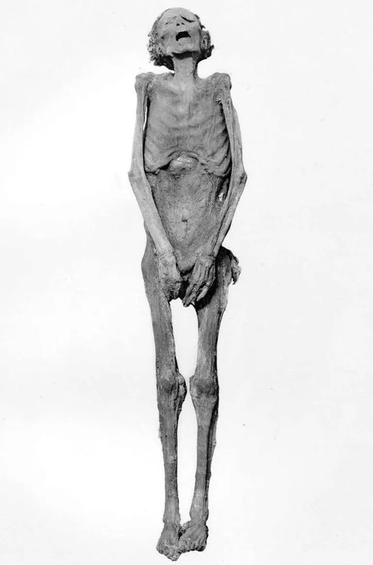 «Karjuv muumia», kes DNA-testi järgi on vaarao Ramses III poeg