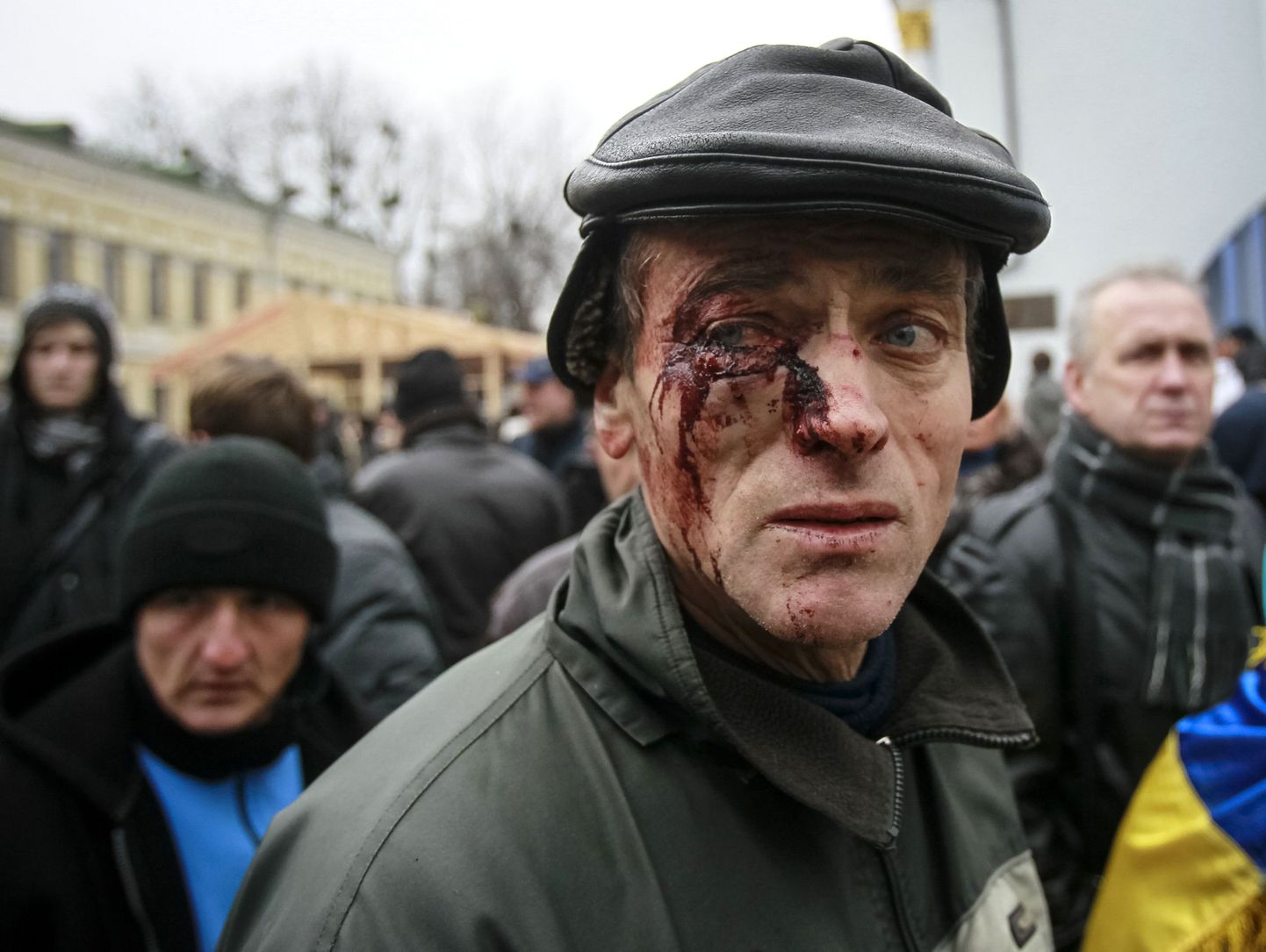 Märulimiilitsaga puhkenud kähmluses viga saanud mees Kiievis.