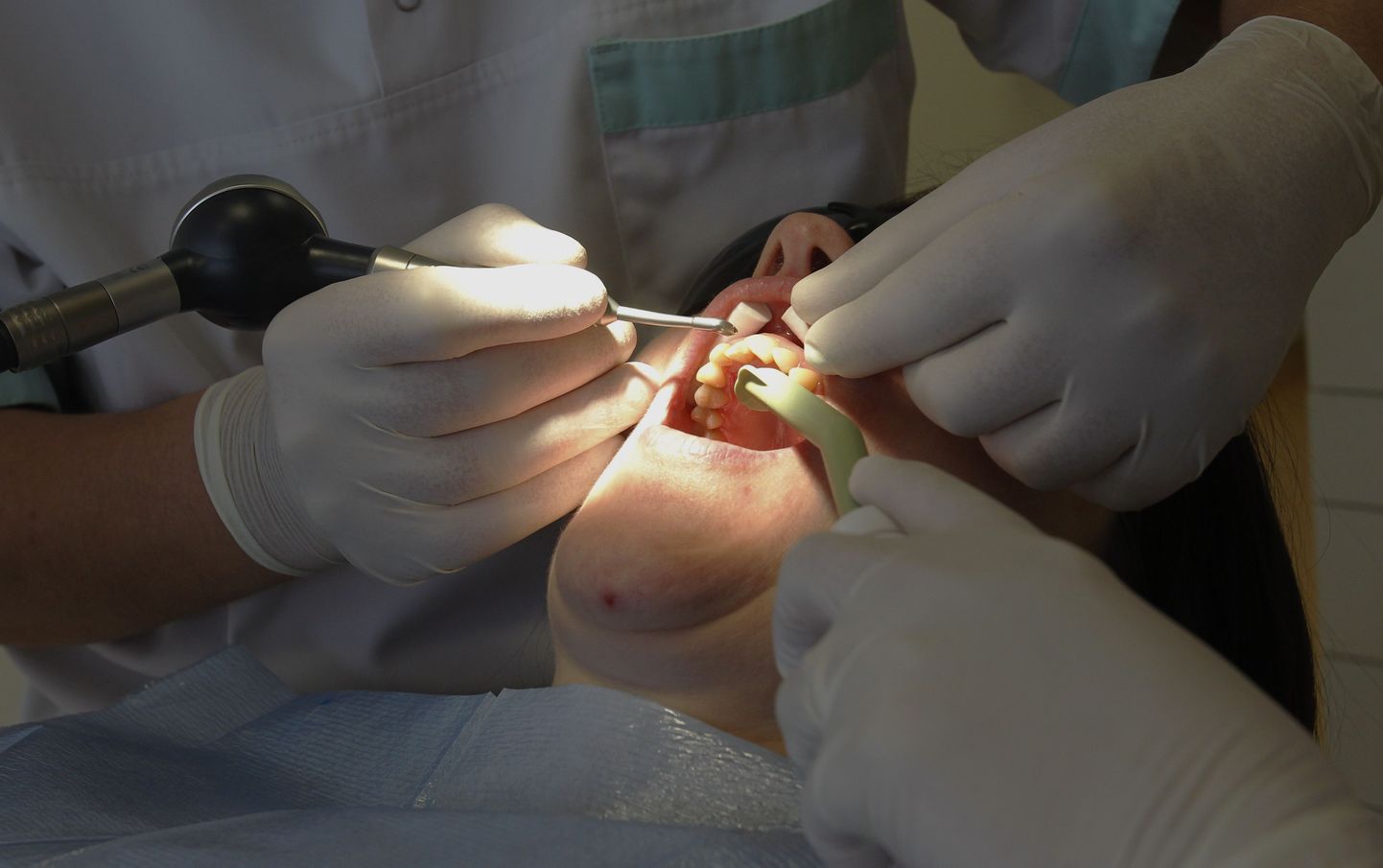 Enamik Eesti hambaarste pole nõus riigi poolt pakutud hindadega tööd tegema.
