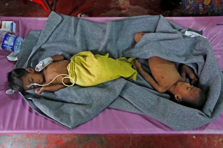 Alatoitunud lapsed Cox's Bazari põgenikelaagris ravi saamas. 