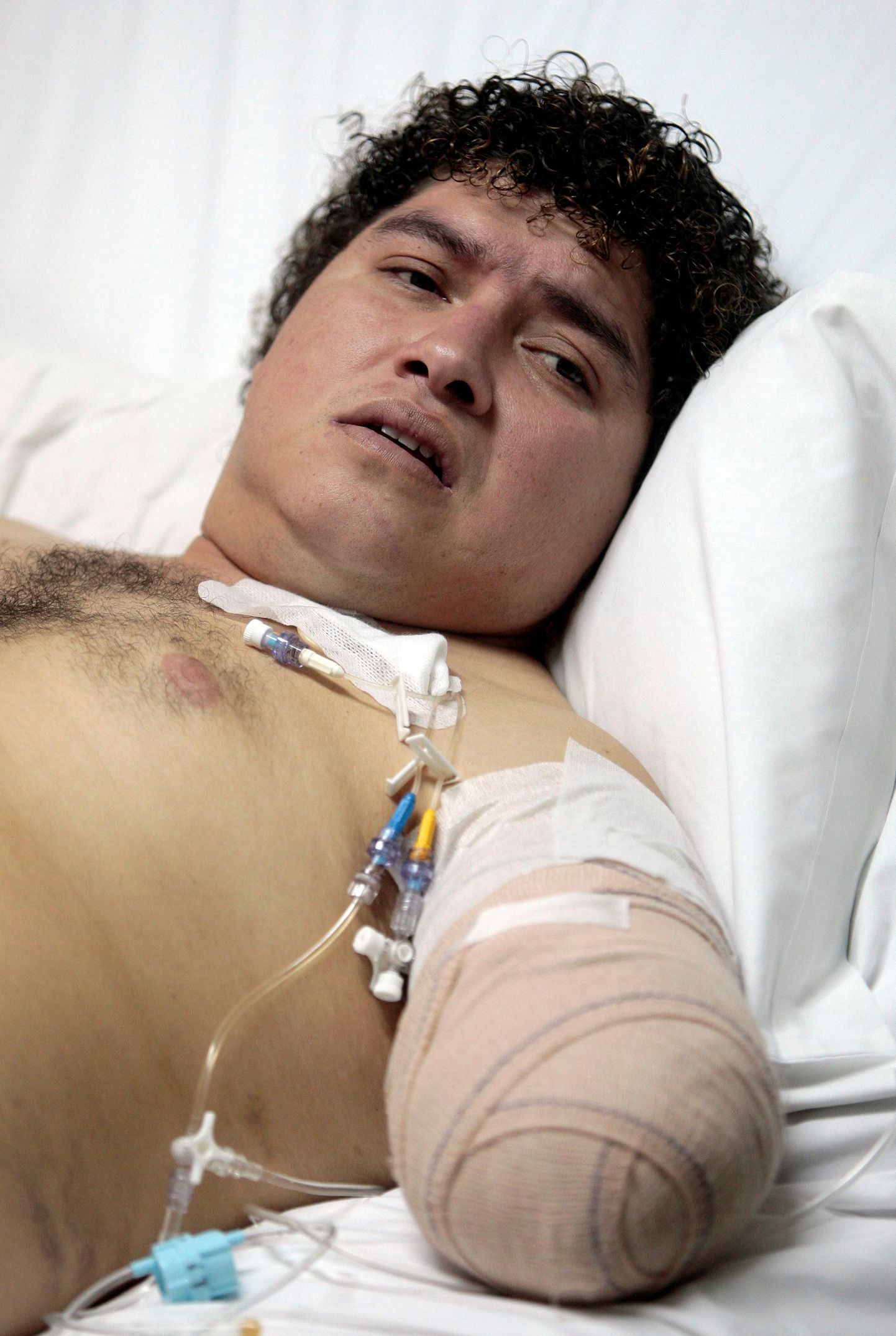 Tööõnnetuses käe kaotanud boliivlane Franns Rilles