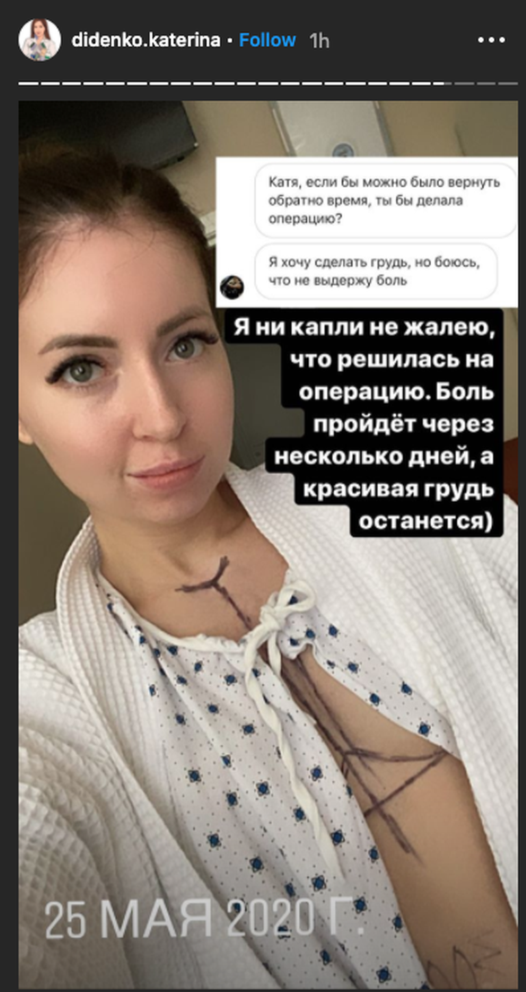 Vene instastaar Jekaterina ei kahetse oma rinnaoperatsiooni.