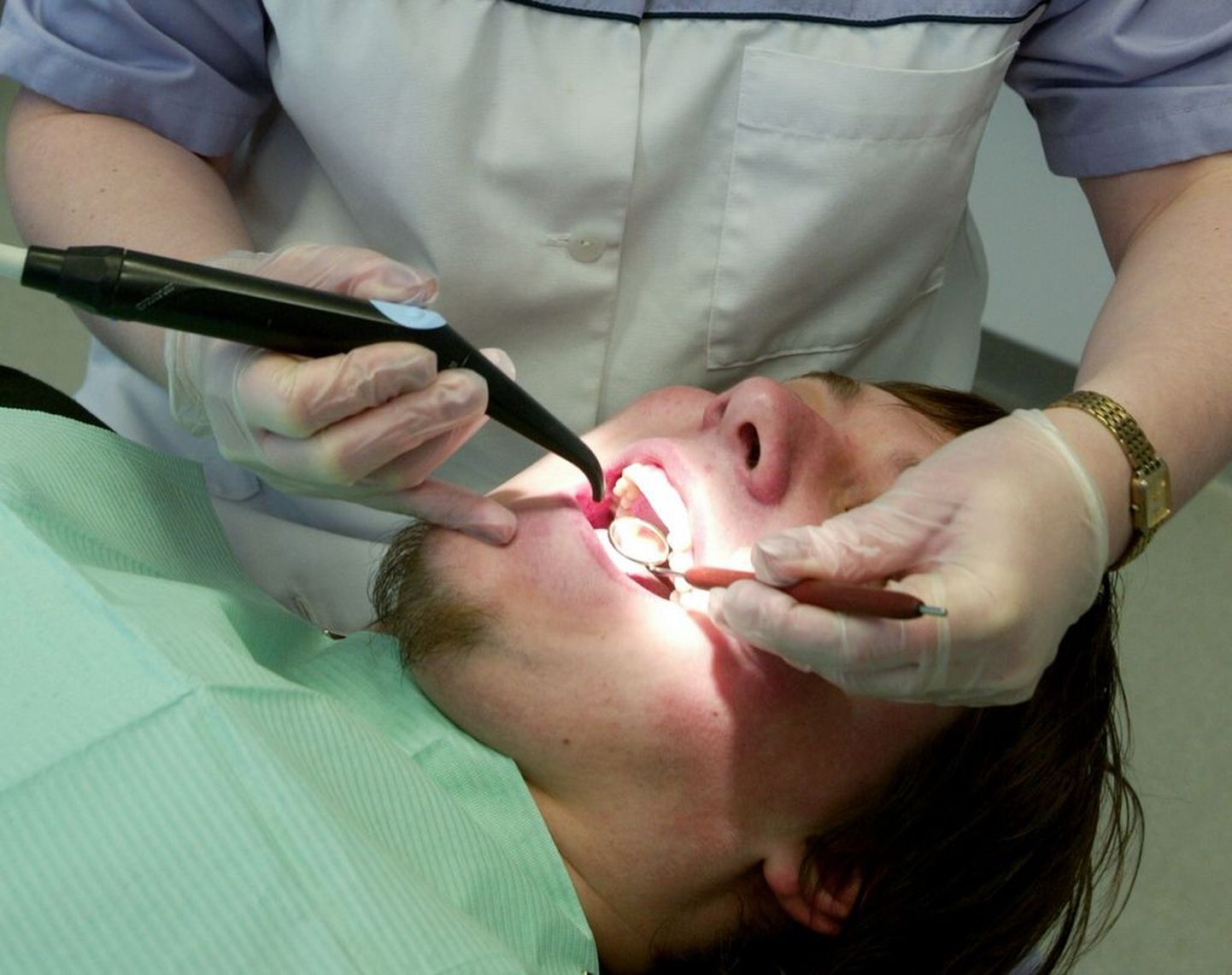 Kurgumandlid ja hambajuure alused peavad psoriaasihaigel olema kindlasti saneeritud, kuna streptokokk-infektsioonid tõstavad psoriaatilise artriidi tekkimise riski.