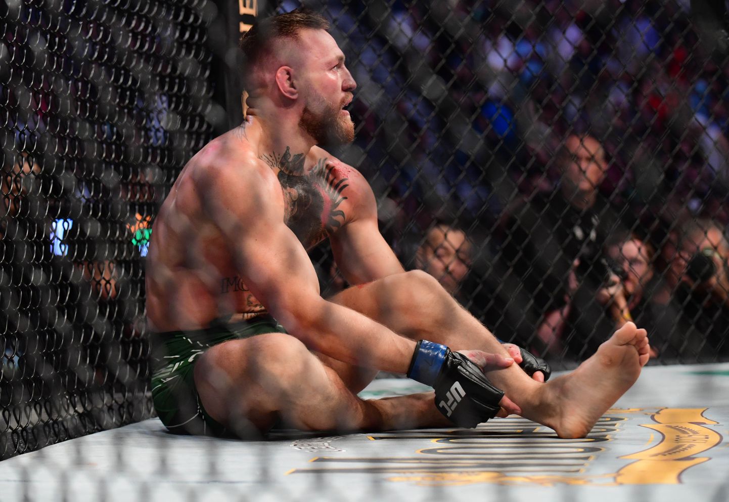 Iiri vabavõitleja Conor McGregor murdis 10. juulil UFC 264 kohtumises sääreluu.