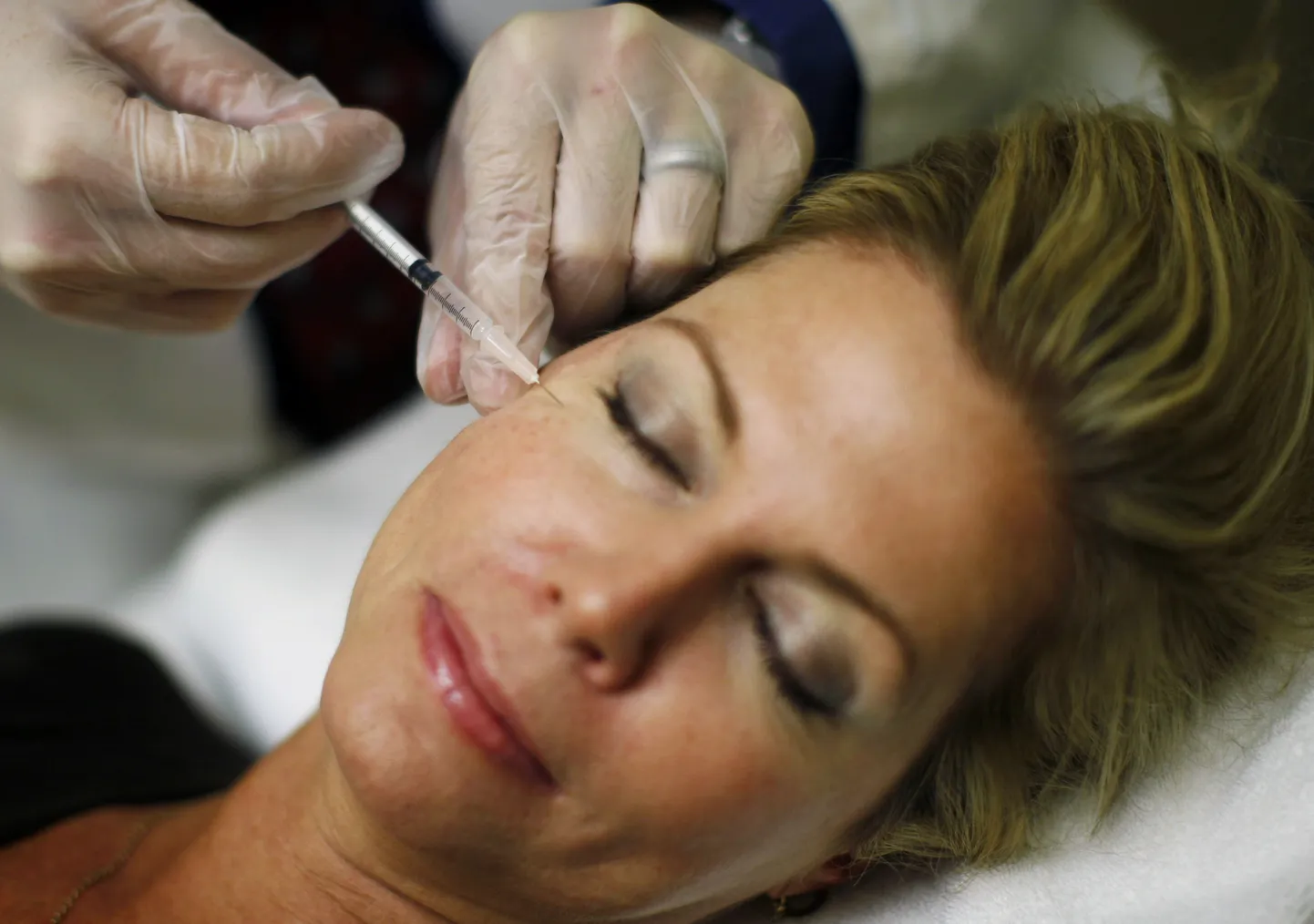 Botox aitab depressiooni ravida?