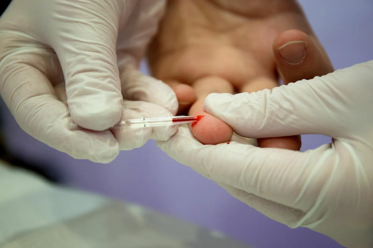Vereproovi võtmine HIV-testi jaoks aastate eest aktsiooni käigus Pärnu Keskuses.