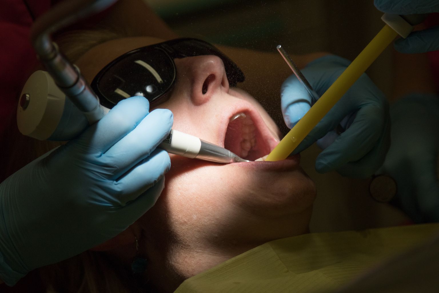 Hambaarst tööd tegemas. Foto on illustratiivne.