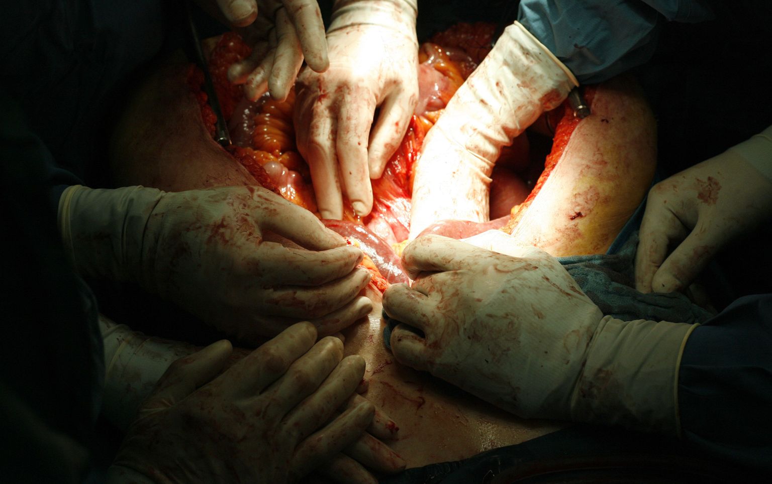 Arstid eemaldamas organeid siirdamiseks.