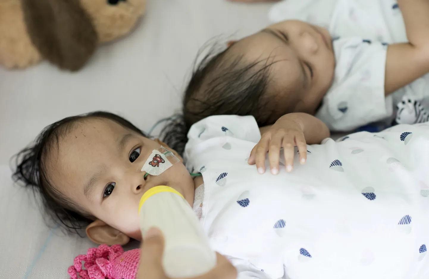 Bhutanist pärit kaksikute Nima ja Dawa üle 185 000 eurost operatsiooni toetas heategevusorganisatsioon Children First Foundation.