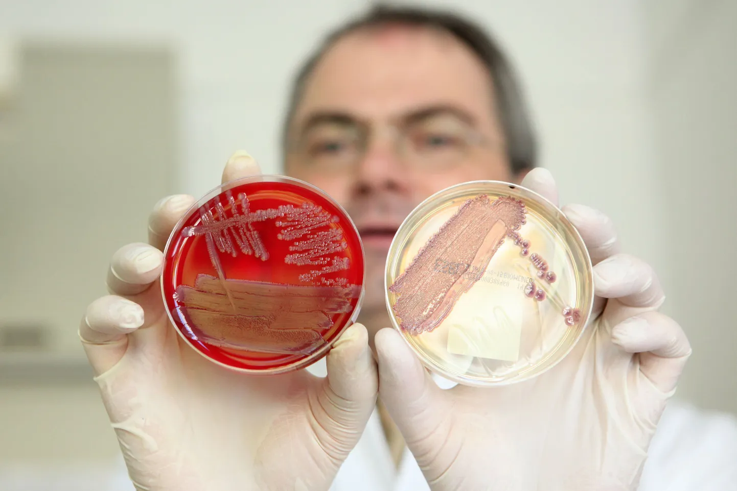 Директор института инфекционной медицины Хельмут Фикеншер демонстрирует колонии кишечной палочки.