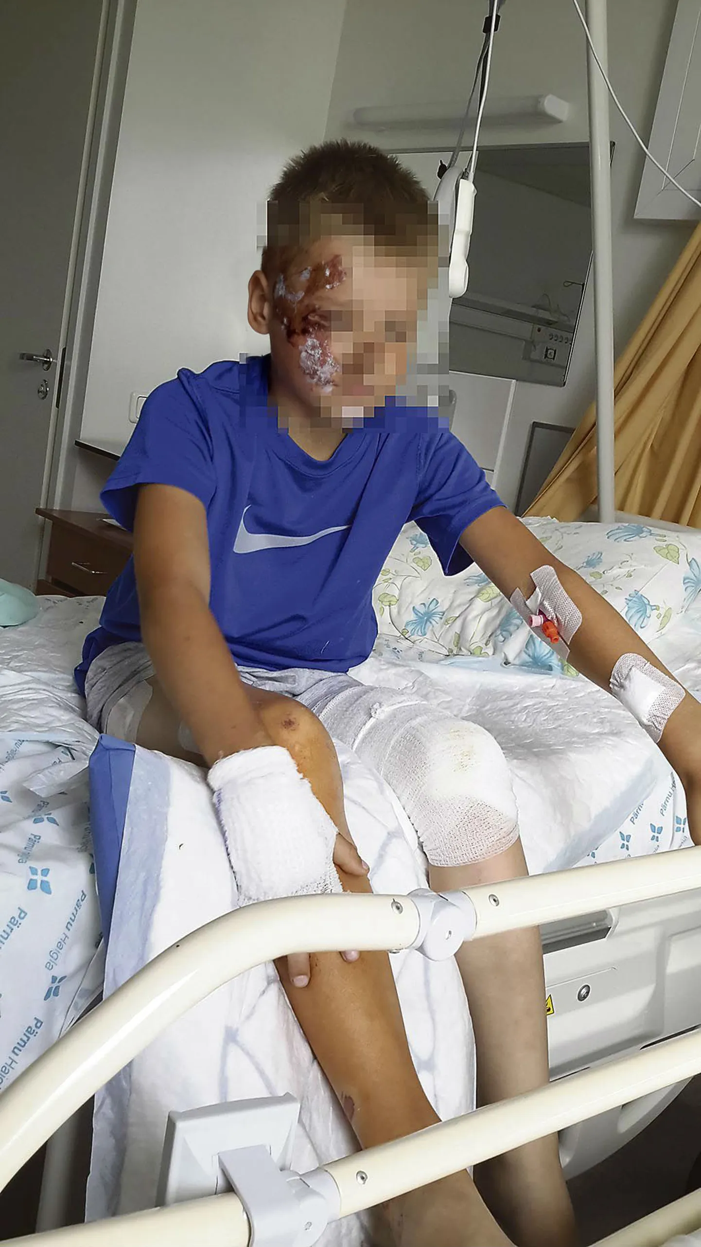 Õnnetuses kannatada saanud laps kolm päeva pärast juhtunut. Elu oli võimalik vaid valuvaigistite abil.