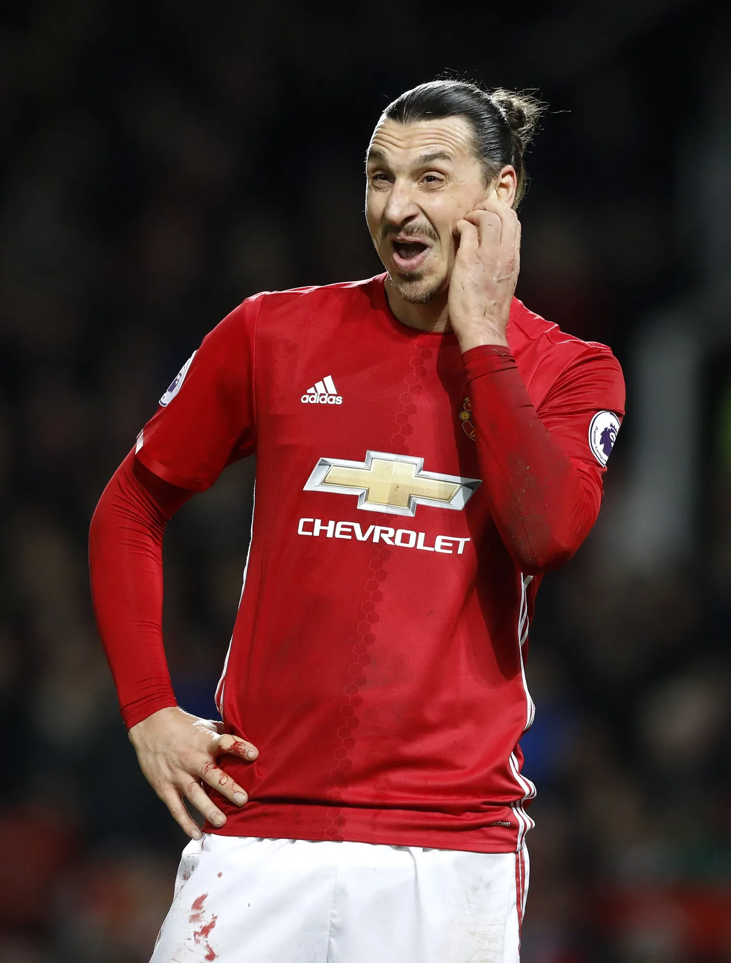 Zlatan Ibrahimovic on alati rääkinud, et ta on erakordne igas mõttes. Nüüd on ründajaga nõustunud ka teda abistanud arstid.