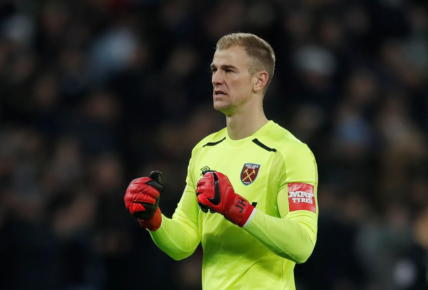 Joe Hart.