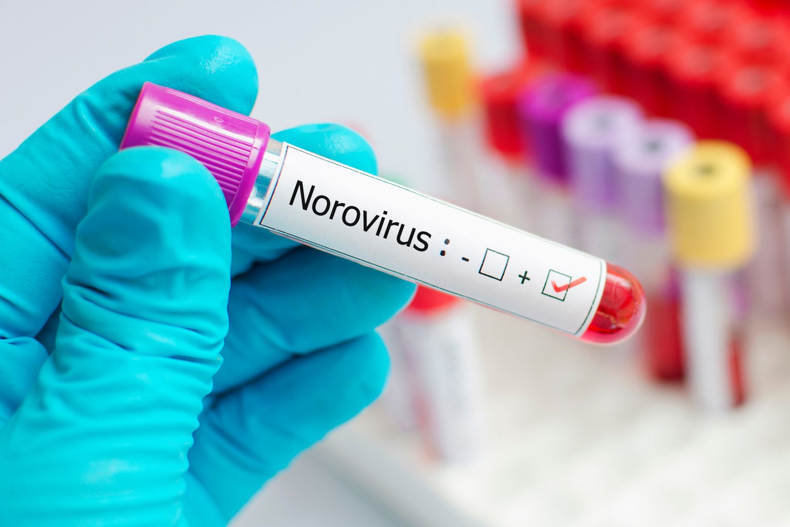 Noroviirus mõjutab igal aastal Ühendkuningriigis peaaegu viit protsenti elanikkonnast.