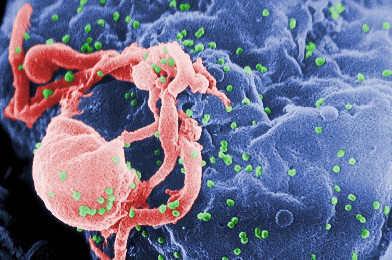 AIDSI põhjustavad HI viirused (rohelistena) kinnitunult inimese lümfitsüüdile. Elektronmikrofoto.