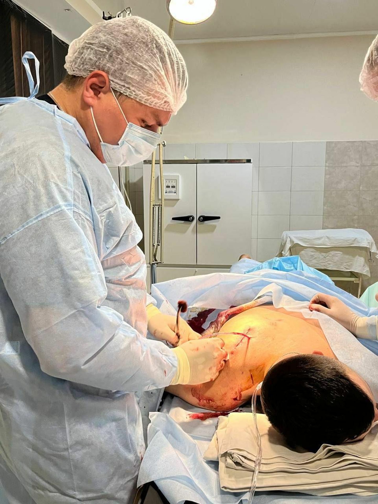 Viis kuud vabatahtlikuna Ukraina sõjaväehaiglas töötanud kirurg Sergii Panasenko ütlust mööda hakkas kolm kuud pärast sõja algust rahvusvahelise abi vähenemine haiglas tunda andma.