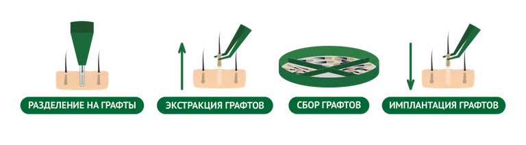 Фото статьи