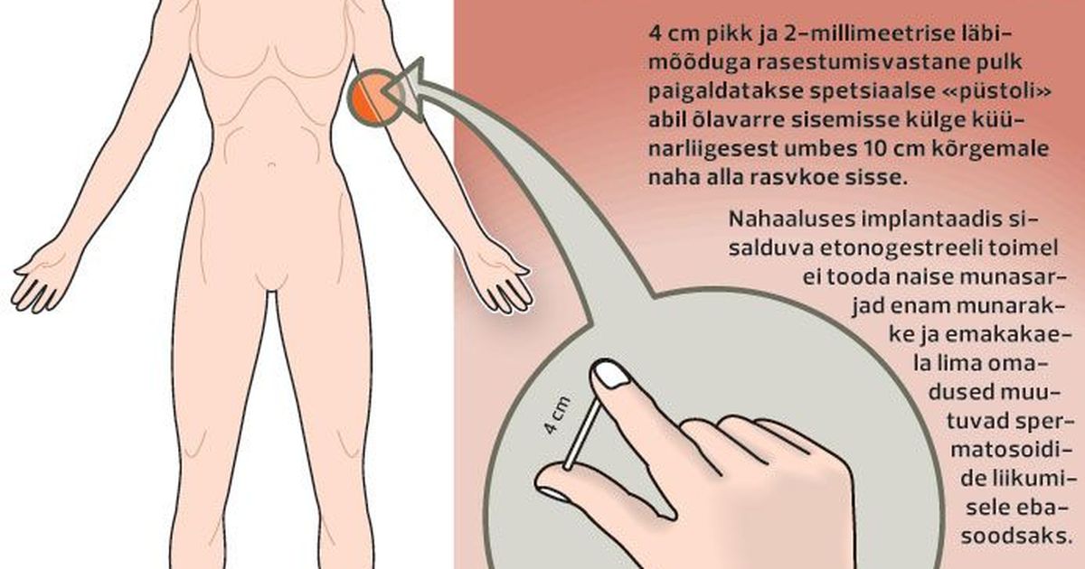 Противозачаточный стул