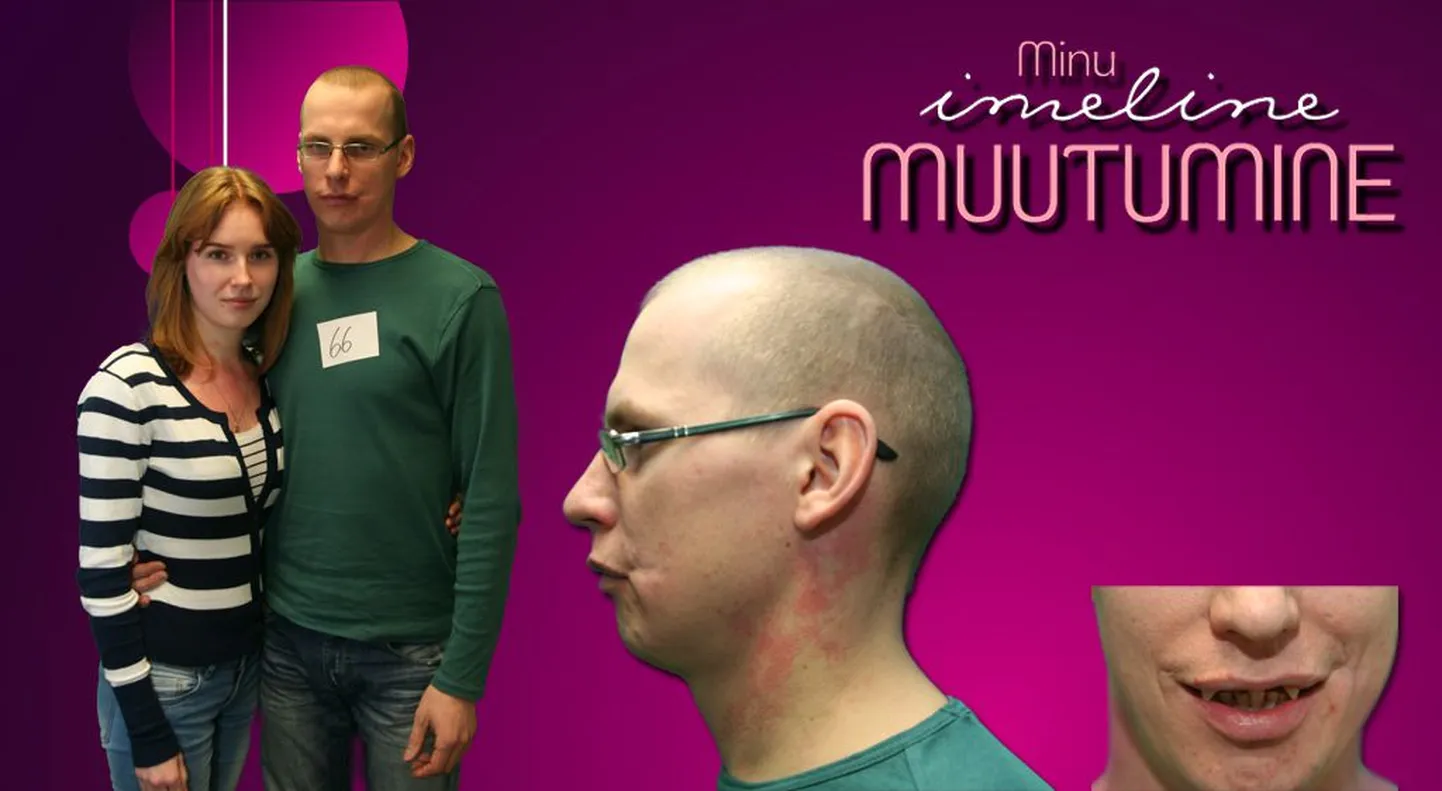 Saade «Minu imeline muutumine», hambutu  Tartu noormees Üllar