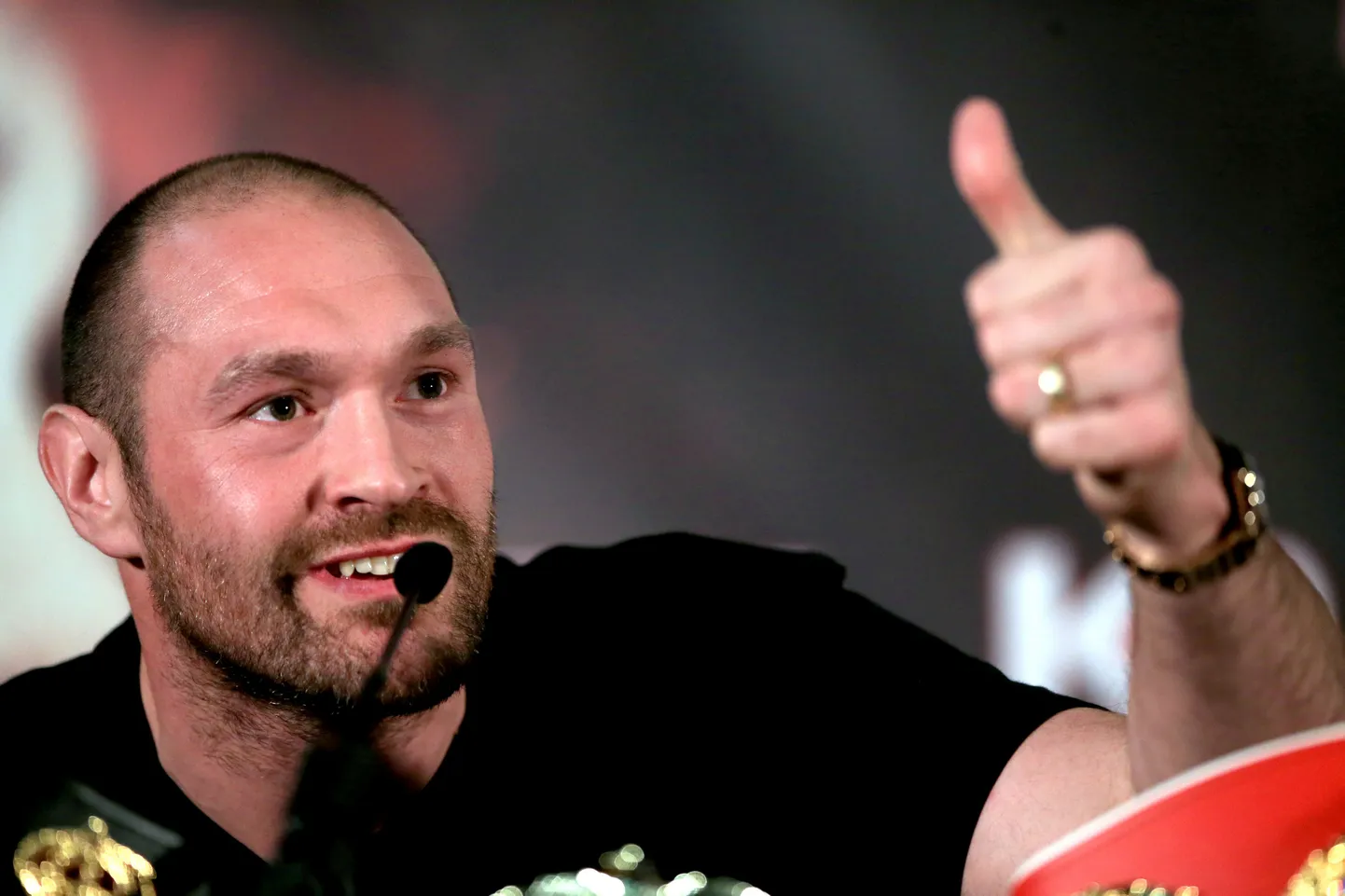 Tyson Fury.