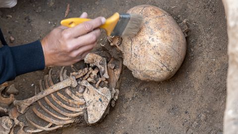 Keskajal Poolas maetud mehel oli kaht tüüpi kääbuslus