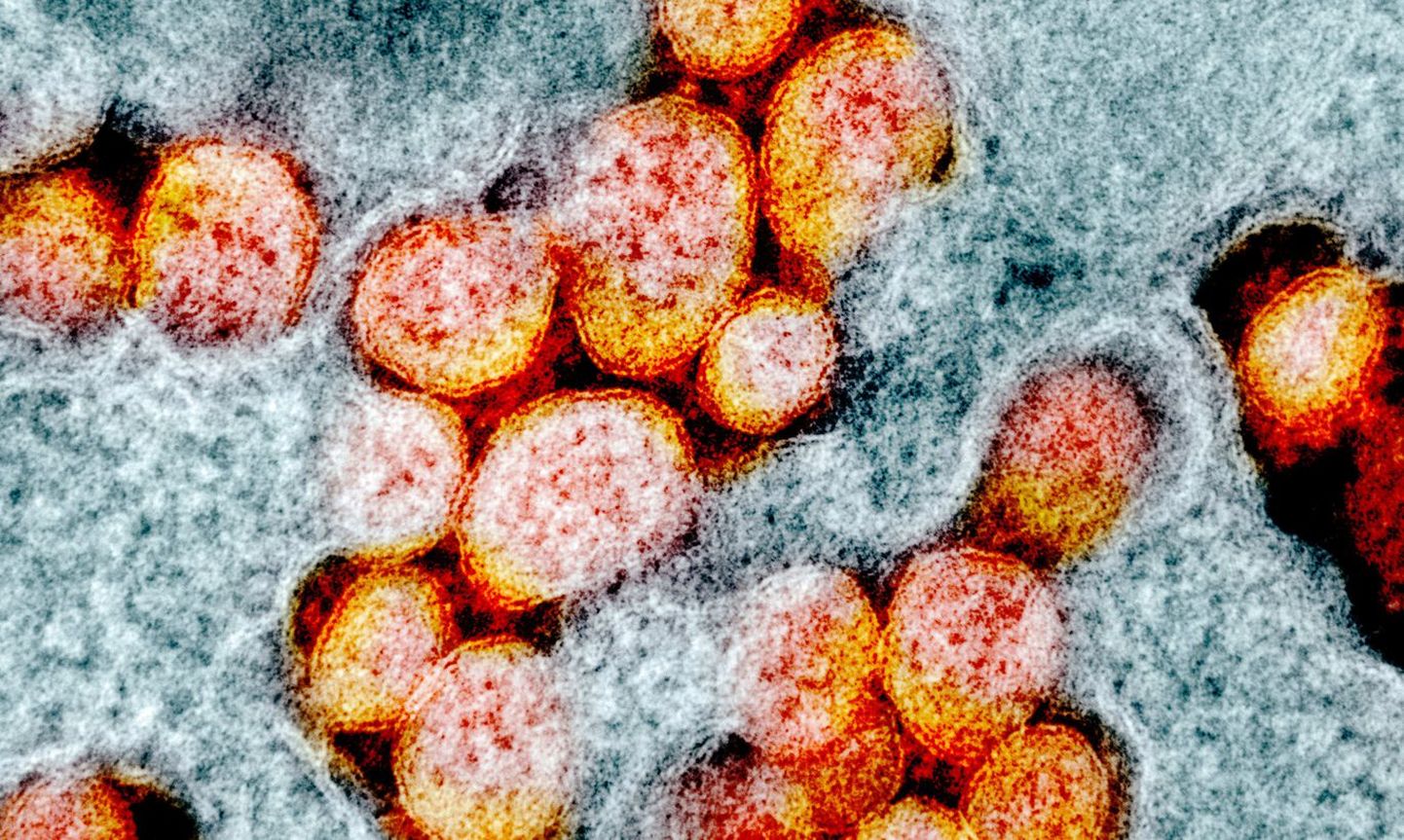 Ученые выяснили, что генетический материал коронавируса можно сделать безвредным.