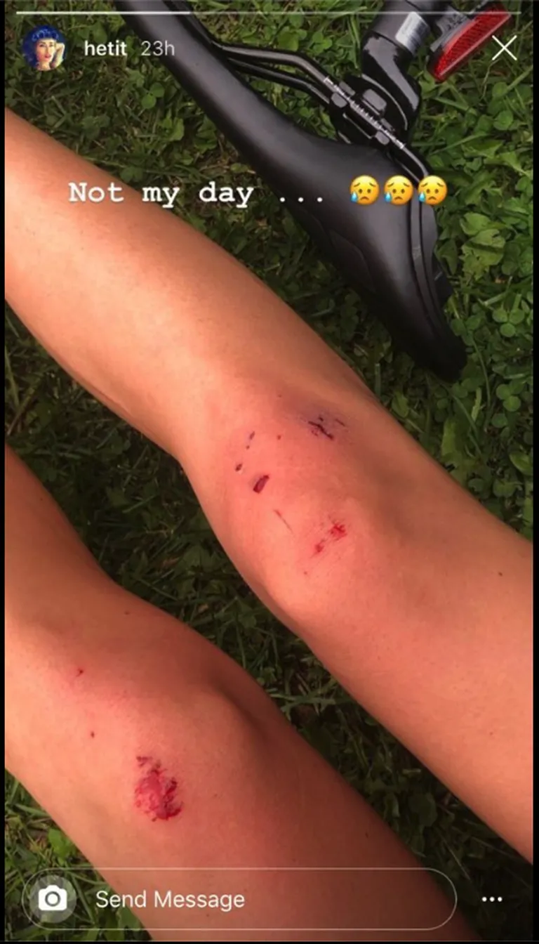 Kuvatõmmis Instagram Story'st: Heti Tulve jagas pilti marraskil põlvedest.
