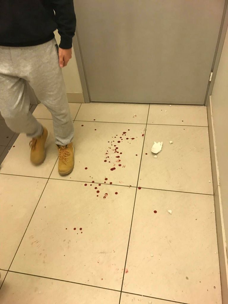 Последствия драки в общественном туалете кохтла-ярвеского торгового центра "Вирония".
