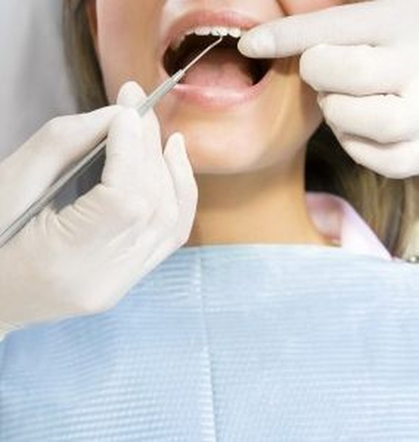 Hambaoperatsioonist ärganud naine hakkas rääkima võõra aktsendiga
