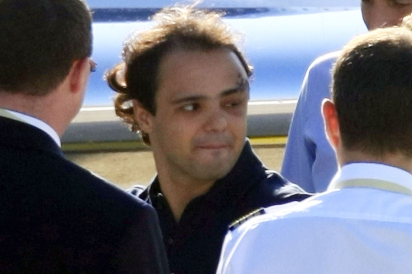 Felipe Massa vasak silm on õnnetusest veel paistes.