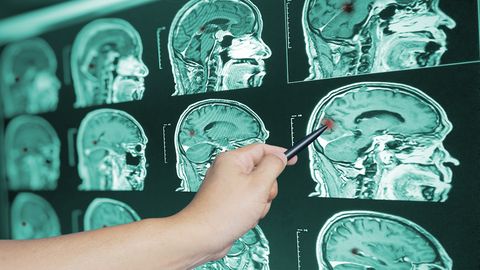ABIKS MEEDIKUTELE ⟩ Uus seade lubab kiiret traumajärgse ajutrauma diagnoosimist