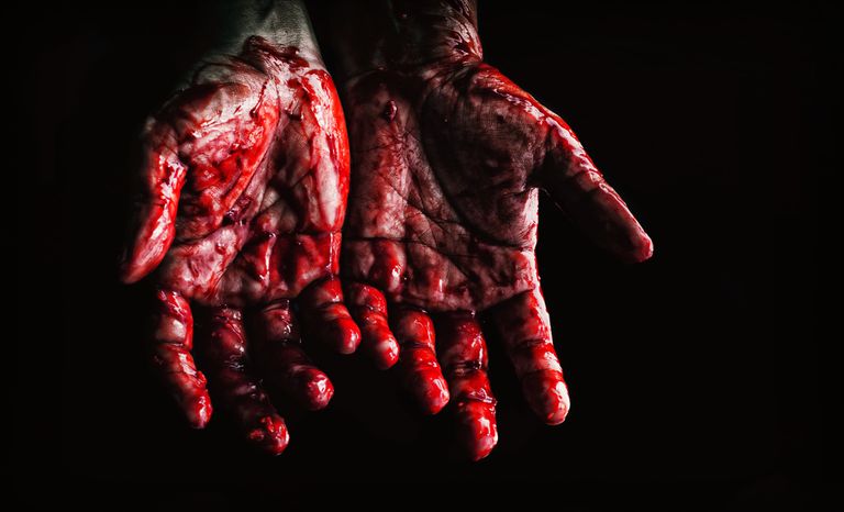 Verised käed. Pilt on illustreeriv