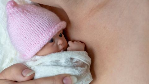 ФОТО ⟩ Новорожденного сильно травмировали в одной из больниц России