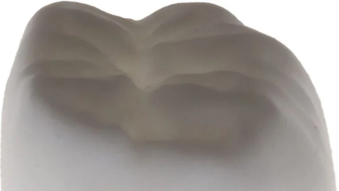 Hambakroonid valmis ühe päevaga – uus 3D-printimise meetod revolutsioneerib hambaarstit