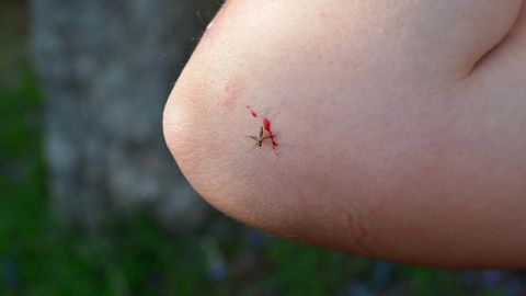 Tulareemia tegi Eestis mullu murettekitava hüppe. Milline on olukord täna ja kes on ohus?