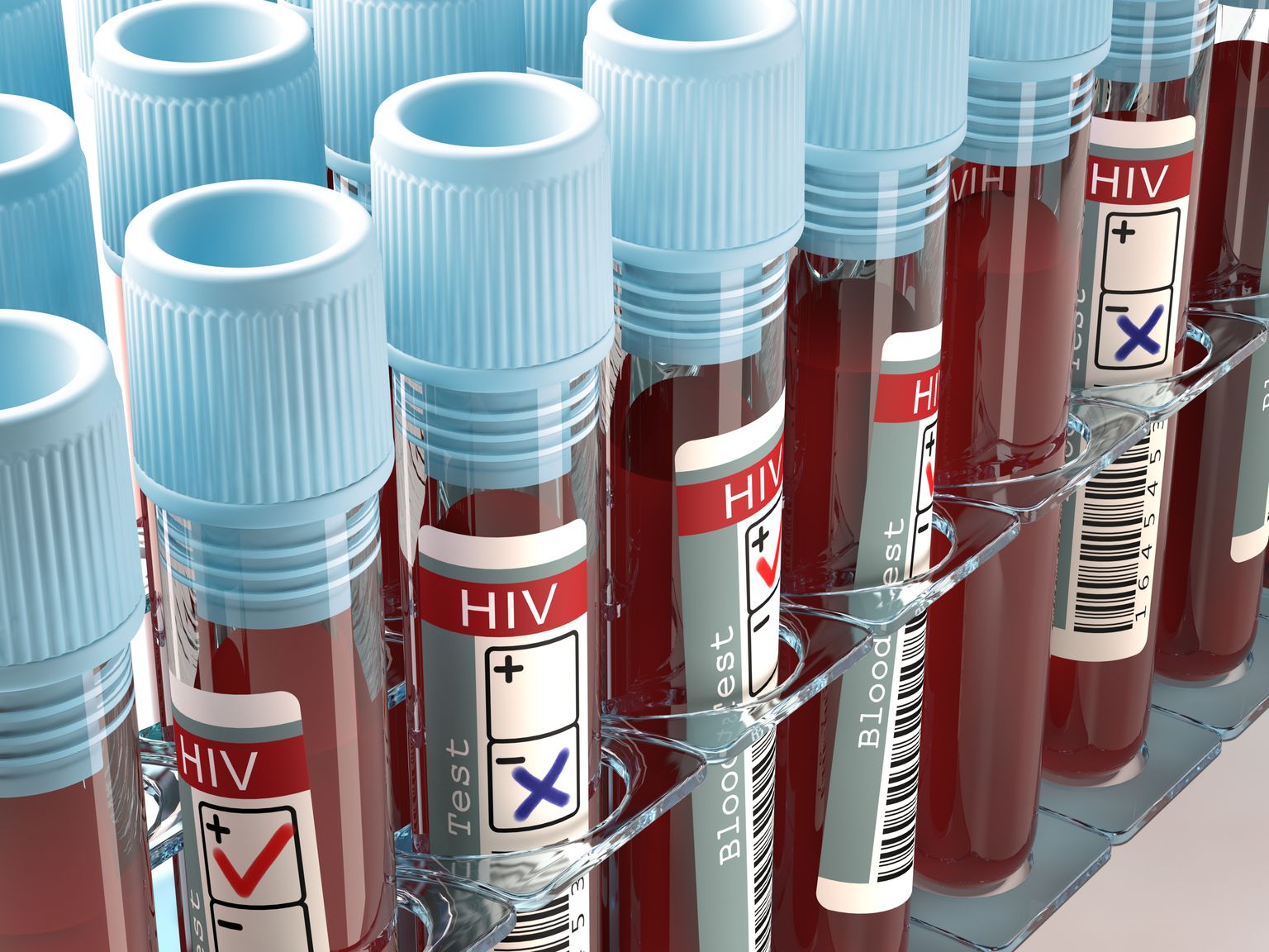 HIVi levimuse tuvastamiseks tuleks testida kõiki, kes on käitunud riskivalt või kelle seksuaalpartner on riskinud.