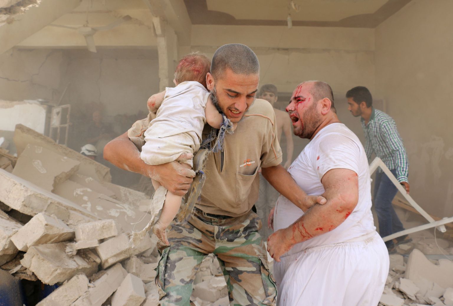 Süüria mees hoiab haavata saanud last süles pärast seda, kui Aleppo eeslinna tabas barrelpommirünnak.