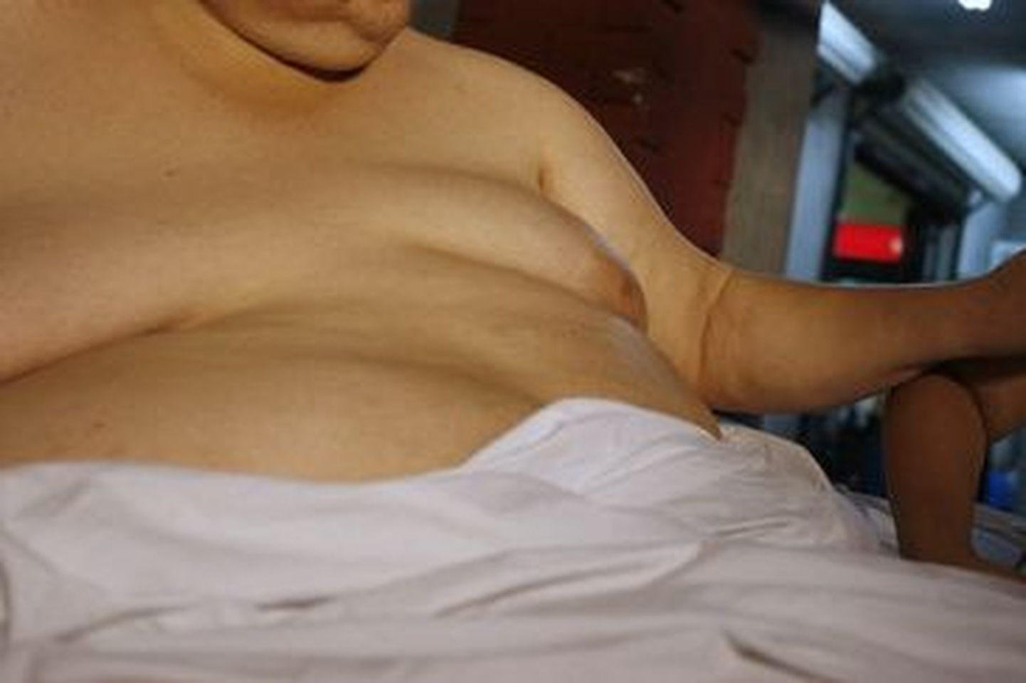 Uuring: austraallased on kõige ülekaalulisemad