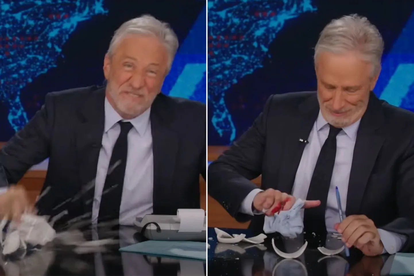 Koomik Jon Stewart vigastas end kogemata telesaates «The Daily Show».