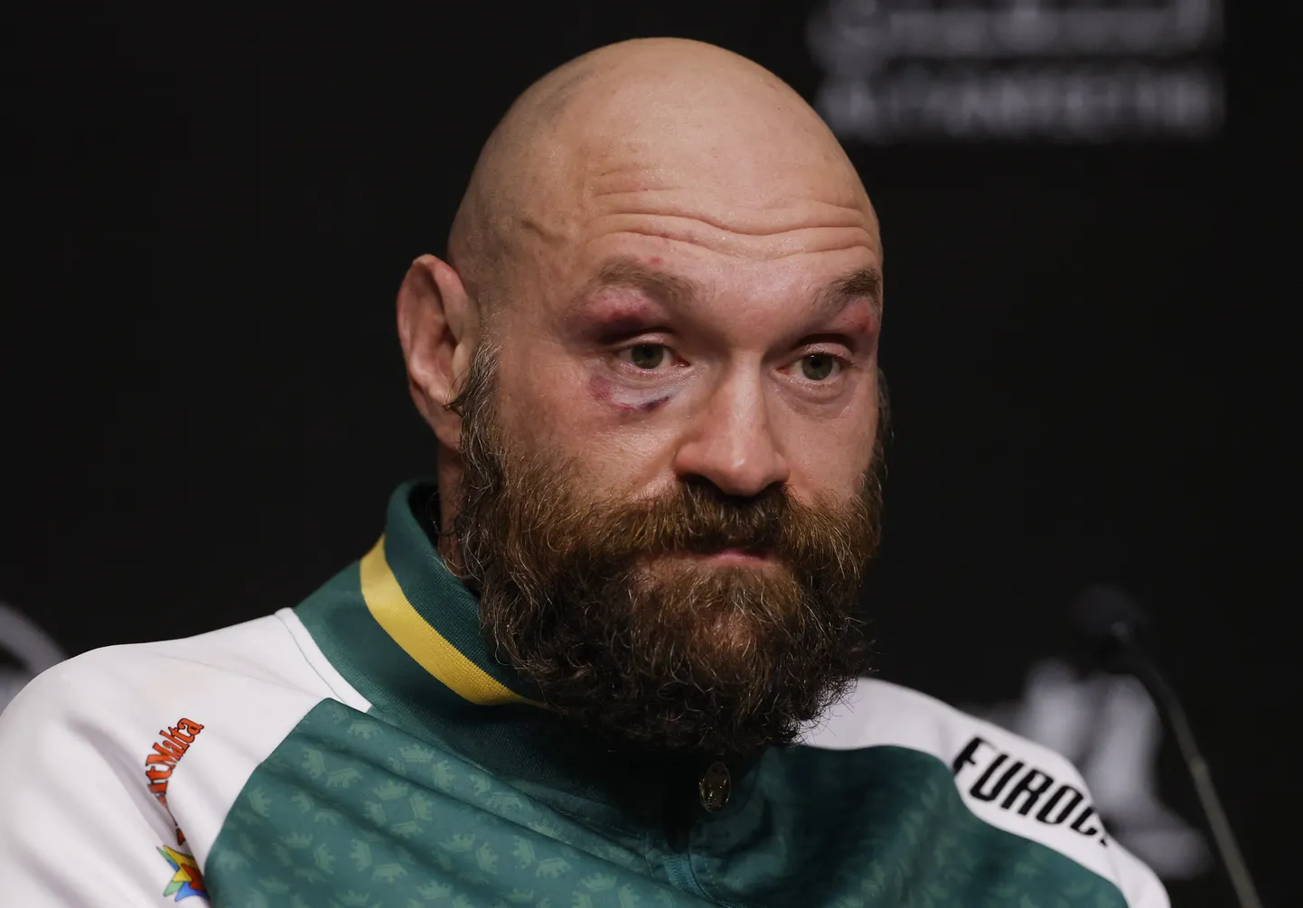 Tyson Fury.