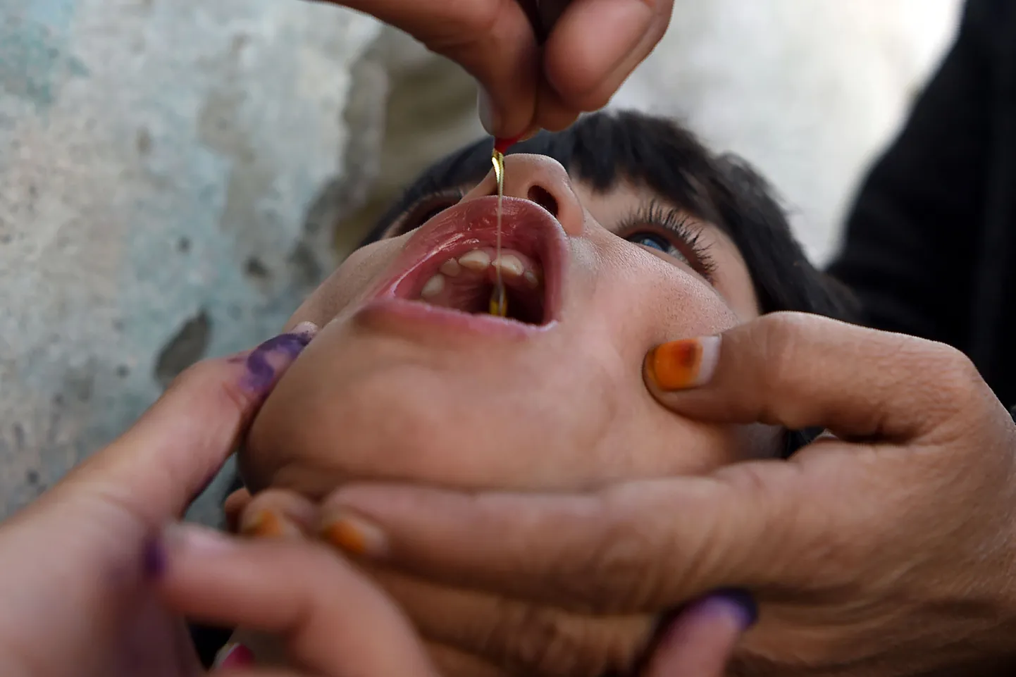 Вакцина от полиомиелита. Фото иллюстративное.