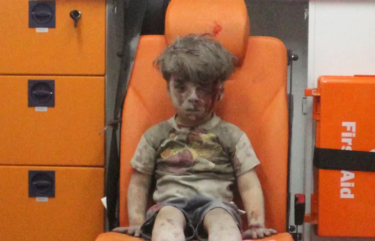 Verega kaetud viieaastane Omran Daqneesh istumas 17. augustil 2016 kiirabiautos