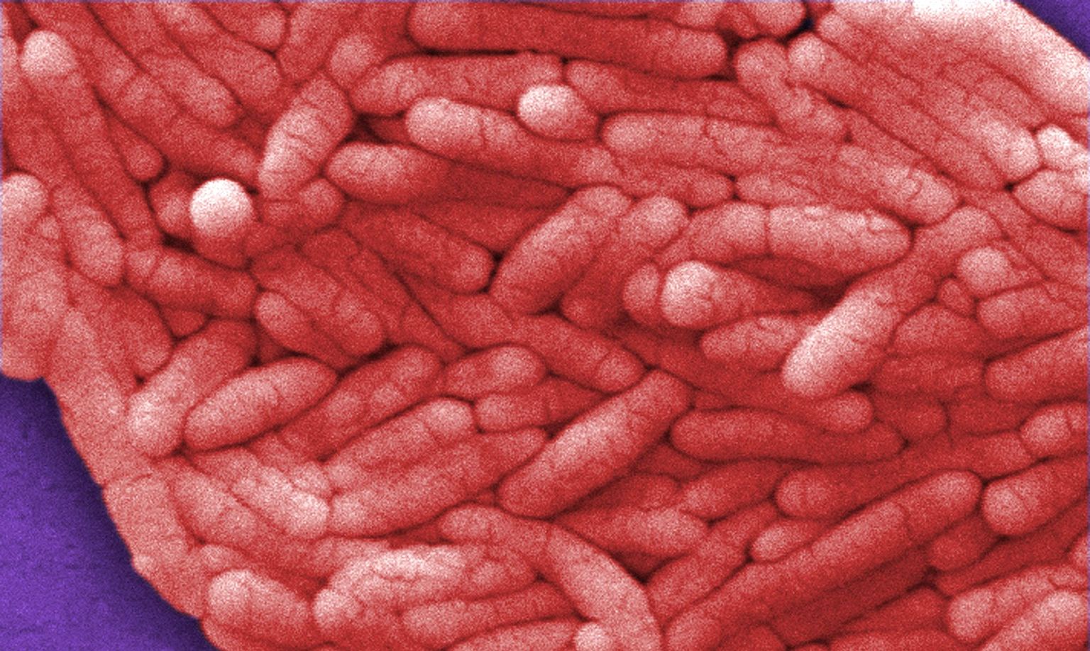 Salmonella bakter 12000 kordse elektronmikroskoobi suurenduse all.