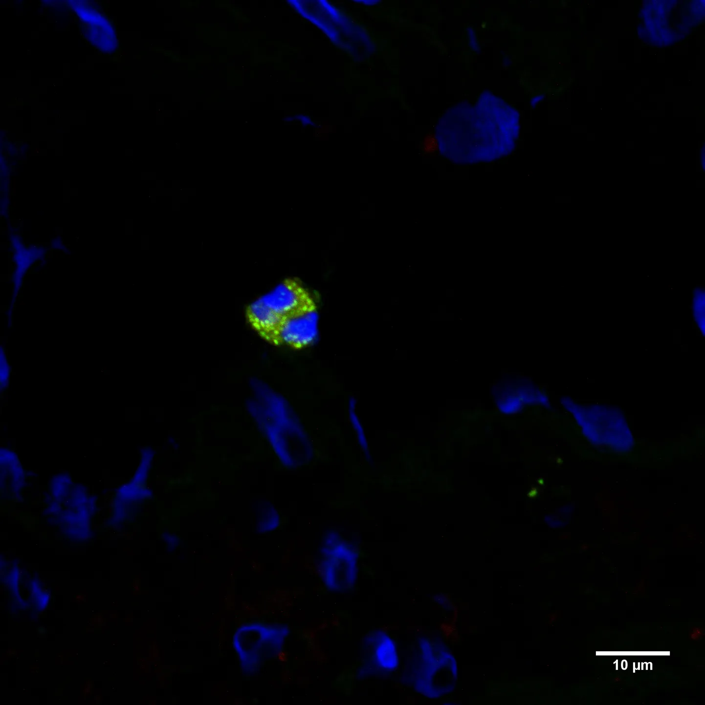 ImageJ=1.51r
unit=\u00B5m